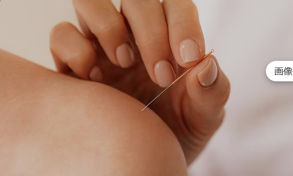 肩こり、腰痛　鍼治療で身体が楽に！